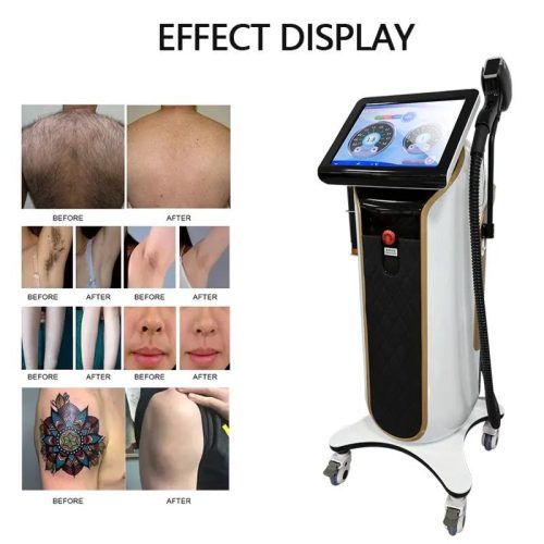 3 Waves 755 808 1064 Alexandrite Diode Laser Hair Removal Ice Platinum Laser Diode - Image 4